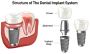 A to Z Dental – The Best Place to Get Dental Implants in Ric