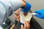 Affordable and Professional Earwax Removal in Cardiff 