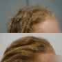Effective Herbal Solutions for Hair Treatment in Perth