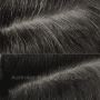 Natural Hair Loss Treatment in Brisbane 