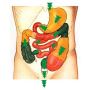 Virechana Panchakarma Procedure | Body Detox | 