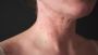 Effective Treatments for Common Skin Diseases