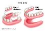 Dentures in Azle, TX