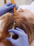 Enhance Your Look with Lip Fillers in Alexandria, VA