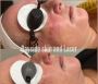 Acne scar treatment Melbourne | Laser treatment for acne