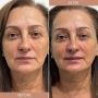Melbourne’s Trusted Cosmetic Clinic – Bayside Skin and Laser