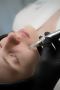 Glow Up with the Best Microneedling Facial Melbourne Has to 