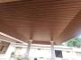 Best Ceiling Soffit Panel for Modern Designs