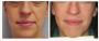 Skin Rejuvenation Clinic Sydney