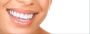 Find the Best Dentist in California | Professional Dentistry