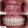 Best Keyhole Dental Surgery in Kolkata