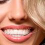 Best Smile Designing in Hyderabad | Transform Your Smile Tod