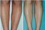 Get the Perfect Glow with Melano Tan 2 – Safe & Effective!
