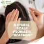 Natural Remedies for Psoriasis Home Treatments That Work