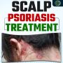 Natural scalp psoriasis treatment soothing solutions for lon