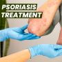Bharat Homeopathy’s customized medicine for Psoriasis ? 
