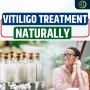Vitiligo Disease Treatment: Effective Medication for Skin Pi