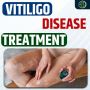 Vitiligo Disease Treatment: Guide to Alternative & Natural C