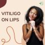 Vitiligo Disease Treatment: Explore Vitiligo Treatment Natur