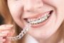 Get Clear Alignment for a Confident Smile in Mumbai