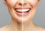 Enhance Your Smile with Smile Designing in Mumbai