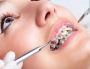 Specialised Orthodontics Services Available in Murwillumbah