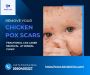 Transform Your Skin: Chicken Pox Scar Removal at Bindal Clin