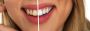 Trusted Teeth Whitening Dentist in Singapore – Book Now!
