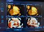 Baby’s First Photos Mississauga