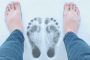Footcare Clinic Tuggerah