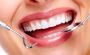 Cosmetic Dentistry in Chandler, Arizona