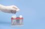 Missing Teeth Repair in Bullhead City, Arizona