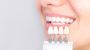 Dental Crowns in Parker, Arizona