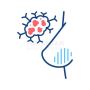  Best Breast Cancer Treatment Hospitals in Bangalore