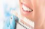 Dental Veneers in Valdosta, GA