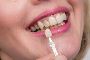 Exceptional Care at Lithia Dentist Bridges Dental