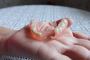 Comfortable & Affordable Partial Dentures in Dawsonville