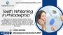 Get a Brighter Smile Today with Teeth Whitening in Bristol