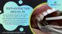 Teeth Extraction Bristol PA