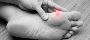 Surgery or Not? Choosing the Right Bunion Treatment  