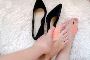 How Long Does Bunion Surgery Recovery Usually Take?
