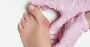 What to Expect During Bunion Surgery Recovery?