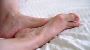5 Signs You Need Minimally Invasive Bunion Surgery