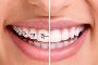 Find Your Dental Emergency Ottawa Now!