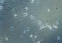 Is a Sperm Test Really Worth It? – Male Hormone Testing