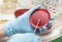 What is a Urine Culture Test, and When is it Needed?