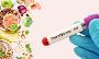 What is a Food Intolerance Test? – Everything You Need to Kn