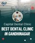 Best Dental Clinic in Gandhinagar – Capital Dental Clinic