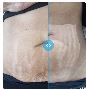 Botox Cardiff