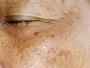 Skin Clinic Cardiff